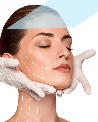 Lifting facial con cirugía - Ritidectomía