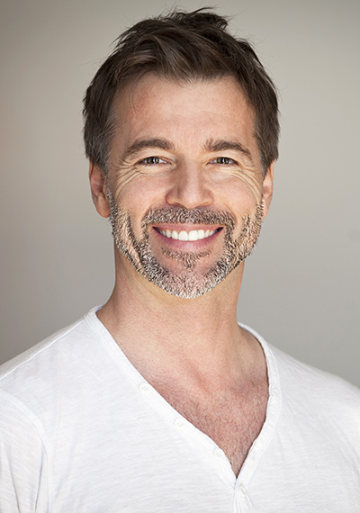 Beneficios del Lifting facial sin cirugía