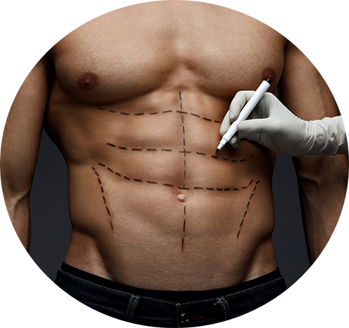 Tratamientos de moldeo corporal sin cirugía cdmx